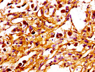 Immunohistochemistry (Formalin/PFA-fixed paraffin-embedded sections) - Anti-PPM1F/POPX2 antibody (AB236884)