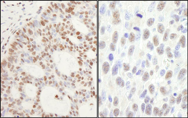 Immunohistochemistry (Formalin/PFA-fixed paraffin-embedded sections) - Anti-PPM1G antibody (AB70794)