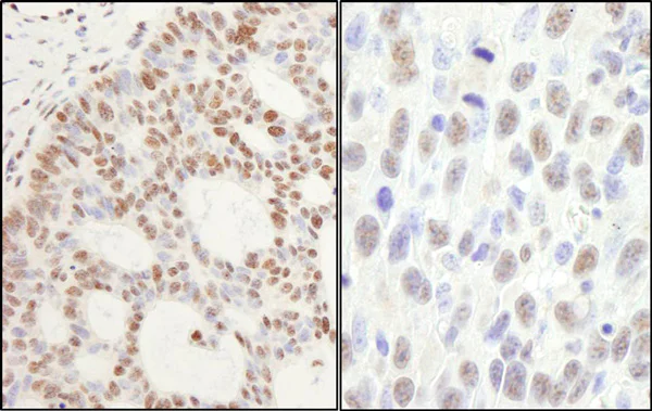 Immunohistochemistry (Formalin/PFA-fixed paraffin-embedded sections) - Anti-PPM1G antibody (AB70794)