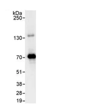 Immunoprecipitation - Anti-PPM1G antibody (AB70794)