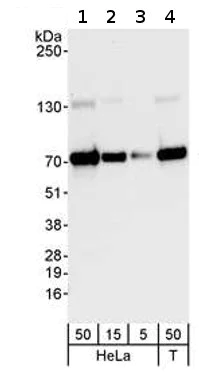 Western blot - Anti-PPM1G antibody (AB70794)