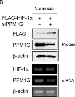 Western blot - Anti-PPM1G antibody (AB70794)