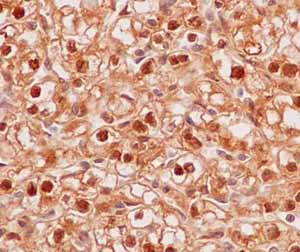 Immunohistochemistry (Formalin/PFA-fixed paraffin-embedded sections) - Anti-PPM1G antibody [EPR13362-31] (AB186423)