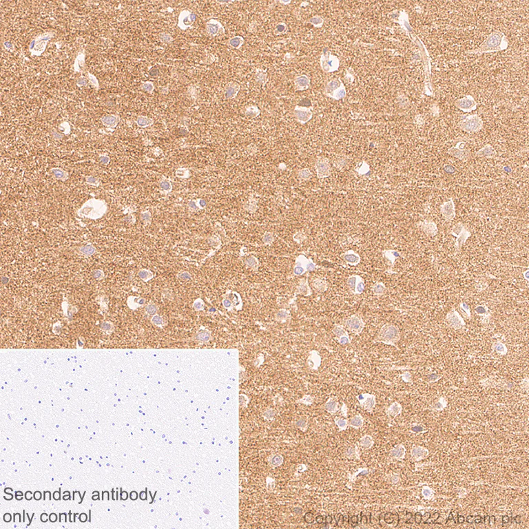 Immunohistochemistry (Formalin/PFA-fixed paraffin-embedded sections) - Anti-PPM1H antibody [EPR26028-53] - BSA and Azide free (AB303537)