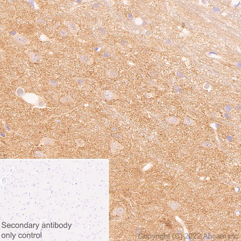 Immunohistochemistry (Formalin/PFA-fixed paraffin-embedded sections) - Anti-PPM1H antibody [EPR26028-53] - BSA and Azide free (AB303537)