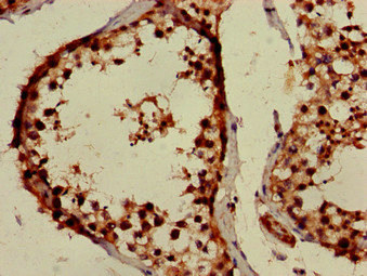 Immunohistochemistry (Formalin/PFA-fixed paraffin-embedded sections) - Anti-PPOX antibody (AB236853)