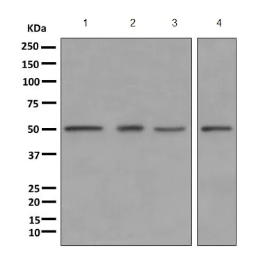 Western blot - Anti-PPOX antibody [EPR10400] (AB170412)