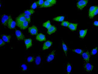 Immunocytochemistry/ Immunofluorescence - Anti-PPOX antibody [EPR10400] - BSA and Azide free (AB249536), expandable thumbnail