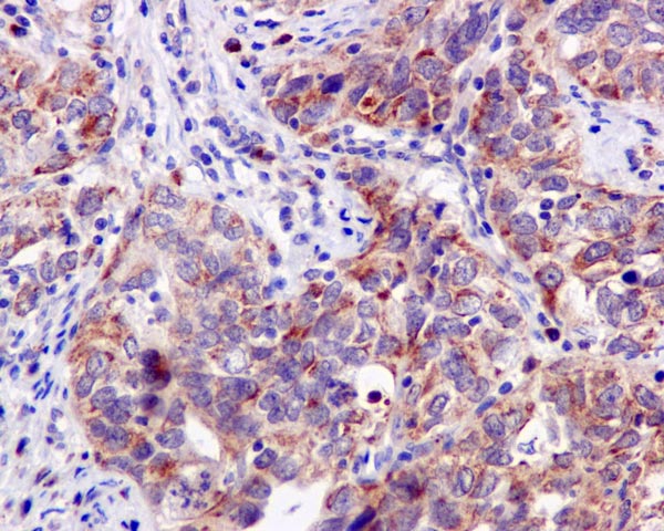 Immunohistochemistry (Formalin/PFA-fixed paraffin-embedded sections) - Anti-PPOX antibody [EPR10401] (AB170884)