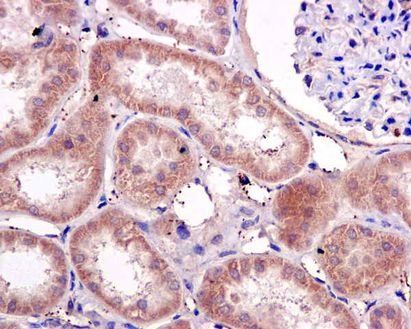 Immunohistochemistry (Formalin/PFA-fixed paraffin-embedded sections) - Anti-PPOX antibody [EPR10401] - BSA and Azide free (AB249564)