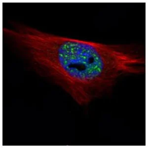 Immunocytochemistry/ Immunofluorescence - Anti-PPP1A/PPP1CA antibody (AB137512)