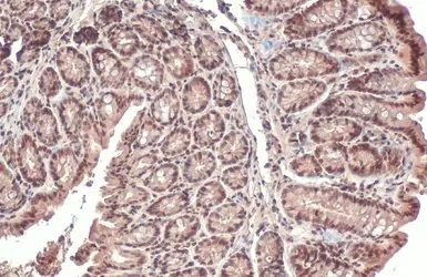 Immunohistochemistry (Formalin/PFA-fixed paraffin-embedded sections) - Anti-PPP1A/PPP1CA antibody (AB137512)