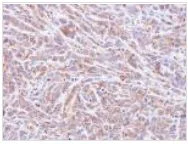 Immunohistochemistry (Formalin/PFA-fixed paraffin-embedded sections) - Anti-PPP1A/PPP1CA antibody (AB137512)