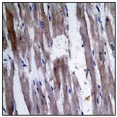 Immunohistochemistry (Formalin/PFA-fixed paraffin-embedded sections) - Anti-PPP1A/PPP1CA (phospho T320) antibody [EP1512Y] (AB62334)