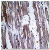 Immunohistochemistry (Formalin/PFA-fixed paraffin-embedded sections) - Anti-PPP1A/PPP1CA (phospho T320) antibody [EP1512Y] - BSA and Azide free (AB284704)