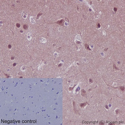 Immunohistochemistry (Formalin/PFA-fixed paraffin-embedded sections) - Anti-PPP1CA + PPP1CB antibody [EP1511Y] (AB52619)