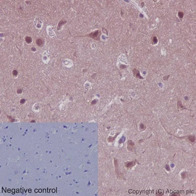 Immunohistochemistry (Formalin/PFA-fixed paraffin-embedded sections) - Anti-PPP1CA + PPP1CB antibody [EP1511Y] (AB52619)
