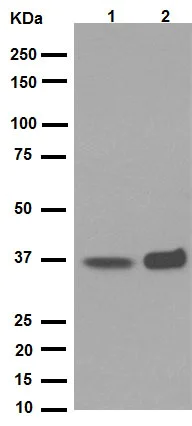 Western blot - Anti-PPP1CA + PPP1CB antibody [EP1511Y] (AB52619)
