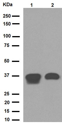 Western blot - Anti-PPP1CA + PPP1CB antibody [EP1511Y] (AB52619)