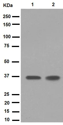Western blot - Anti-PPP1CA + PPP1CB antibody [EP1511Y] (AB52619)
