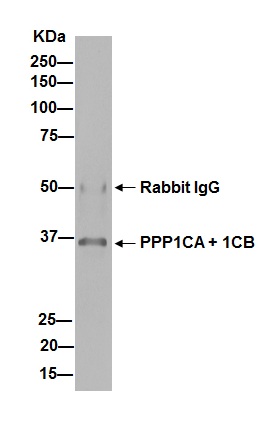 Immunoprecipitation - Anti-PPP1CA + PPP1CB antibody [EP1511Y] - BSA and Azide free (AB239844), expandable thumbnail