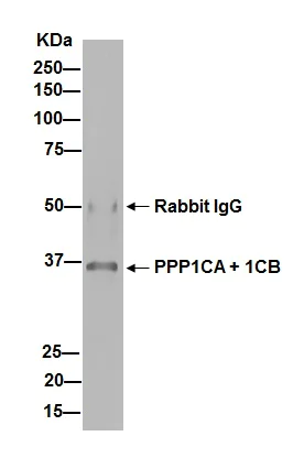 Immunoprecipitation - Anti-PPP1CA + PPP1CB antibody [EP1511Y] - BSA and Azide free (AB239844)