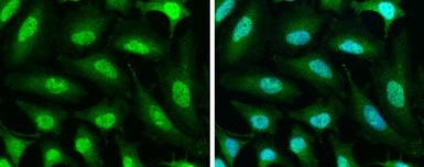 Immunocytochemistry/ Immunofluorescence - Anti-PPP1CB antibody (AB154600)