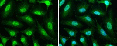 Immunocytochemistry/ Immunofluorescence - Anti-PPP1CB antibody (AB154600)