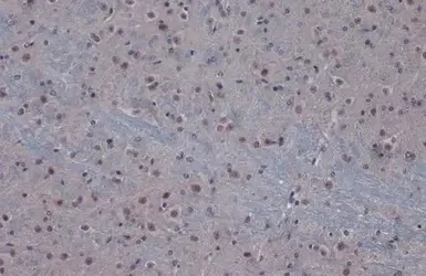 Immunohistochemistry (Formalin/PFA-fixed paraffin-embedded sections) - Anti-PPP1CB antibody (AB154600)