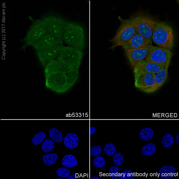 Immunocytochemistry/ Immunofluorescence - Anti-PPP1CB antibody [EP1804Y] (AB53315)