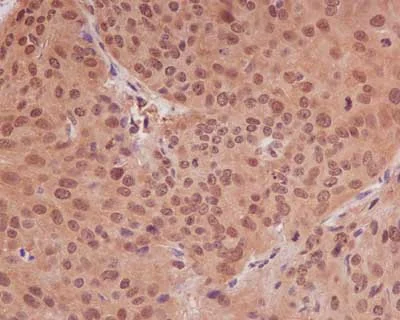 Immunohistochemistry (Formalin/PFA-fixed paraffin-embedded sections) - Anti-PPP1CB antibody [EP1804Y] (AB53315)