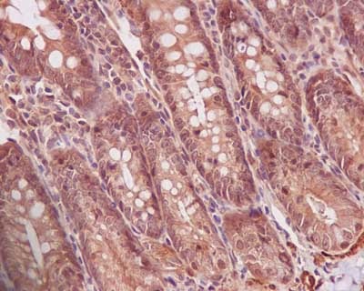 Immunohistochemistry (Formalin/PFA-fixed paraffin-embedded sections) - Anti-PPP1CB antibody [EP1804Y] (ab53315), expandable thumbnail
