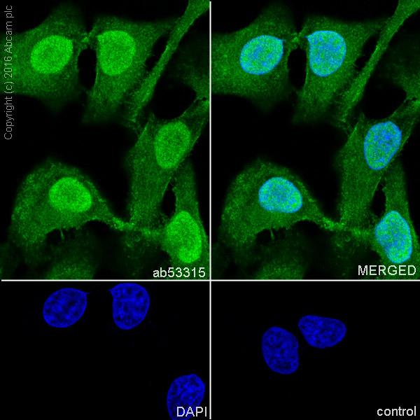 Immunocytochemistry/ Immunofluorescence - Anti-PPP1CB antibody [EP1804Y] - BSA and Azide free (AB284701), expandable thumbnail