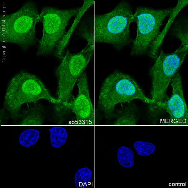 Immunocytochemistry/ Immunofluorescence - Anti-PPP1CB antibody [EP1804Y] - BSA and Azide free (AB284701)