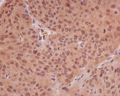 Immunohistochemistry (Formalin/PFA-fixed paraffin-embedded sections) - Anti-PPP1CB antibody [EP1804Y] - BSA and Azide free (ab284701), expandable thumbnail