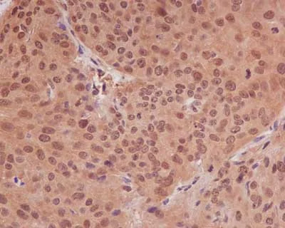 Immunohistochemistry (Formalin/PFA-fixed paraffin-embedded sections) - Anti-PPP1CB antibody [EP1804Y] - BSA and Azide free (AB284701)