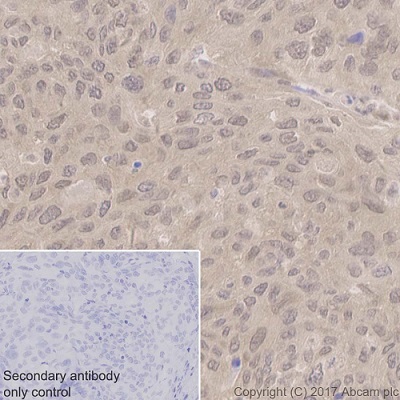 Immunohistochemistry (Formalin/PFA-fixed paraffin-embedded sections) - Anti-PPP1CB antibody [EP1804Y] - BSA and Azide free (AB284701), expandable thumbnail
