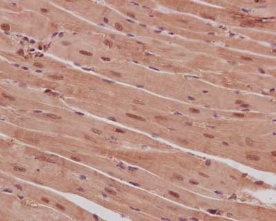 Immunohistochemistry (Formalin/PFA-fixed paraffin-embedded sections) - Anti-PPP1CB antibody [EP1804Y] - BSA and Azide free (ab284701), expandable thumbnail