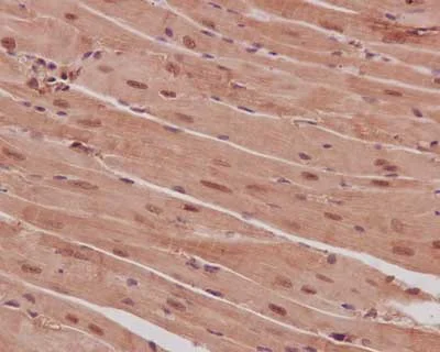 Immunohistochemistry (Formalin/PFA-fixed paraffin-embedded sections) - Anti-PPP1CB antibody [EP1804Y] - BSA and Azide free (AB284701)