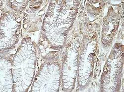 Immunohistochemistry (Formalin/PFA-fixed paraffin-embedded sections) - Anti-PPP1R11 antibody (AB177043)