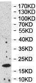 Western blot - Anti-PPP1R11 antibody (AB177043)