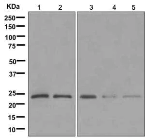 Western blot - Anti-PPP1R11 antibody [EPR11965] (AB171960)
