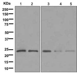 Western blot - Anti-PPP1R11 antibody [EPR11965] - BSA and Azide free (AB249675), expandable thumbnail
