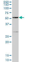 Western blot - Anti-PPP1R16A antibody (AB89135)