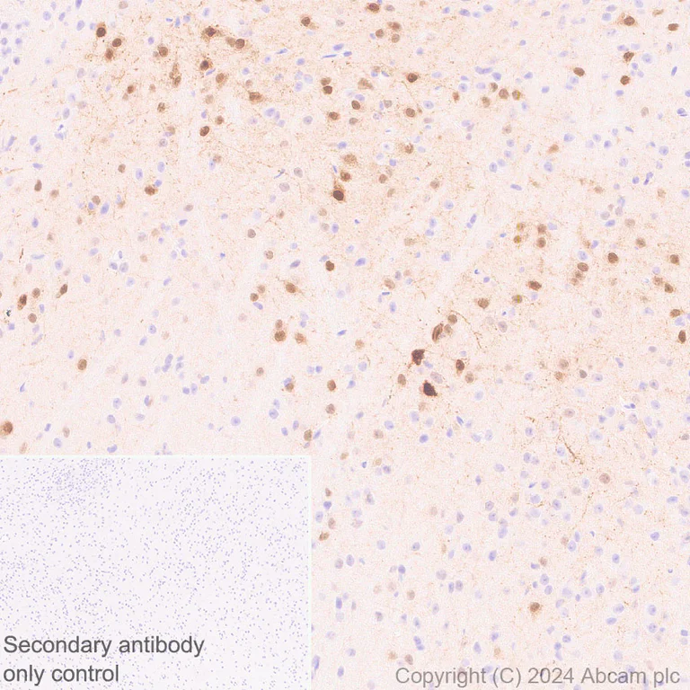 Immunohistochemistry (Formalin/PFA-fixed paraffin-embedded sections) - Anti-Ppp1r17 antibody [EPR29124-227] (AB317831)
