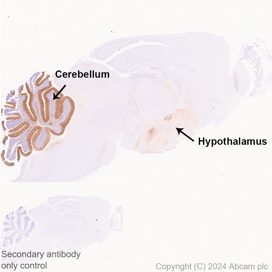 Immunohistochemistry (Formalin/PFA-fixed paraffin-embedded sections) - Anti-Ppp1r17 antibody [EPR29124-227] (ab317831), expandable thumbnail