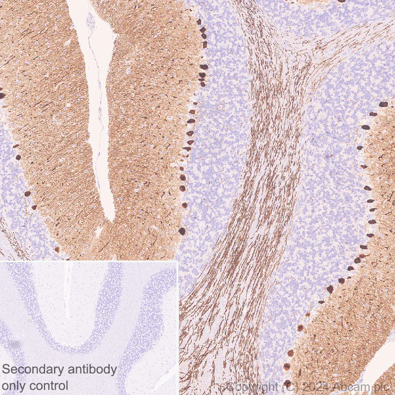 Immunohistochemistry (Formalin/PFA-fixed paraffin-embedded sections) - Anti-Ppp1r17 antibody [EPR29124-227] (AB317831)