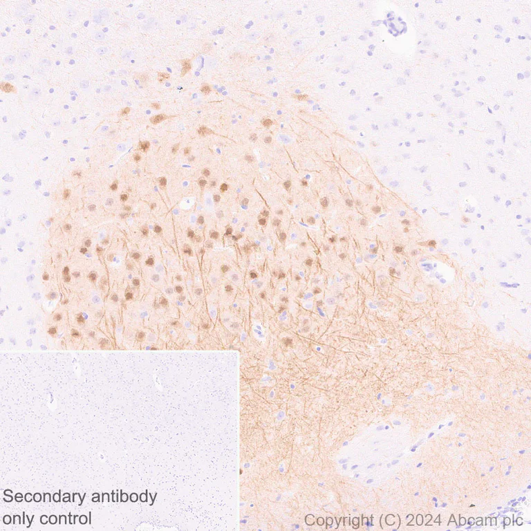Immunohistochemistry (Formalin/PFA-fixed paraffin-embedded sections) - Anti-Ppp1r17 antibody [EPR29124-227] (AB317831)