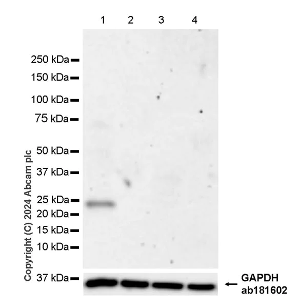 Western blot - Anti-Ppp1r17 antibody [EPR29124-227] (AB317831)