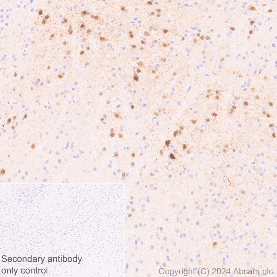 Immunohistochemistry (Formalin/PFA-fixed paraffin-embedded sections) - Anti-Ppp1r17 antibody [EPR29124-227] - BSA and Azide free (ab317832), expandable thumbnail